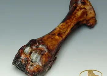 Bas de la jambe